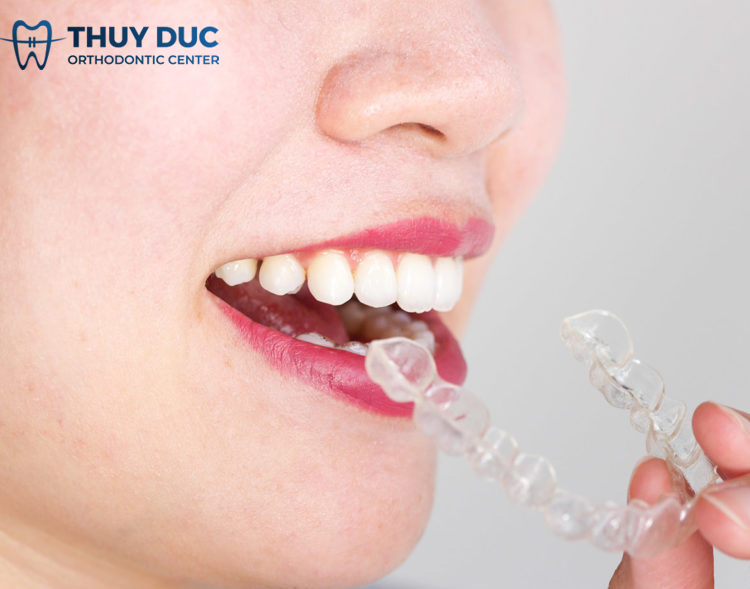 Làm thế nào để giọng nói không bị ảnh hưởng bởi niềng răng? 1 Làm thế nào để giọng nói không bị ảnh hưởng bởi niềng răng? 1