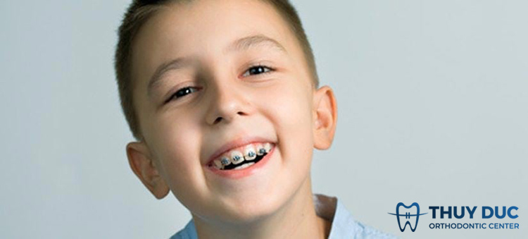 Phương pháp điều trị khớp cắn hở 2