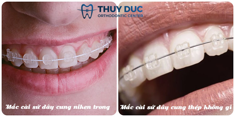 Phần dây cung 1 Phần dây cung 1