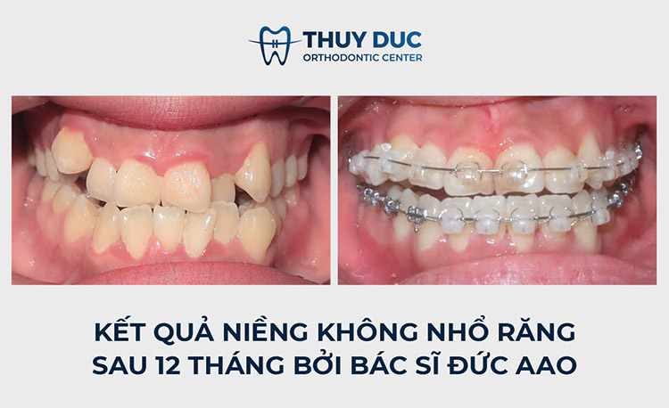 Bác sĩ Phạm Hồng Đức- chuyên gia chỉnh nha AAO 2 Bác sĩ Phạm Hồng Đức- chuyên gia chỉnh nha AAO 2