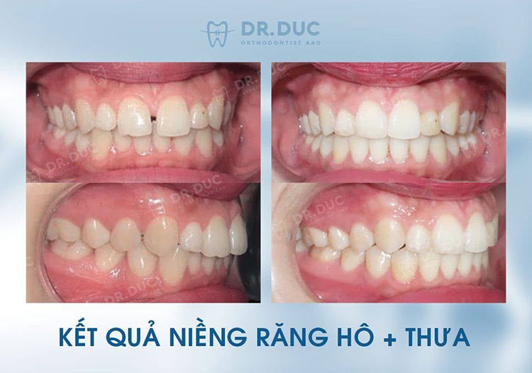 Bác sĩ Phạm Hồng Đức- chuyên gia chỉnh nha AAO 2