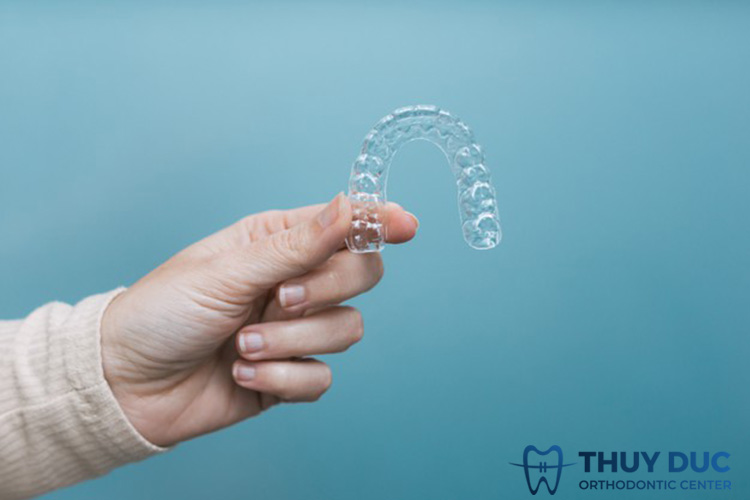 Niềng răng trong suốt mất thời gian bao lâu? 1