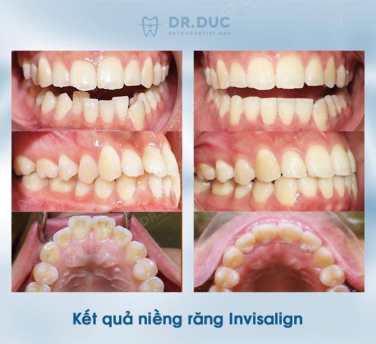Bác sĩ Phạm Hồng Đức- chuyên gia chỉnh nha AAO 2