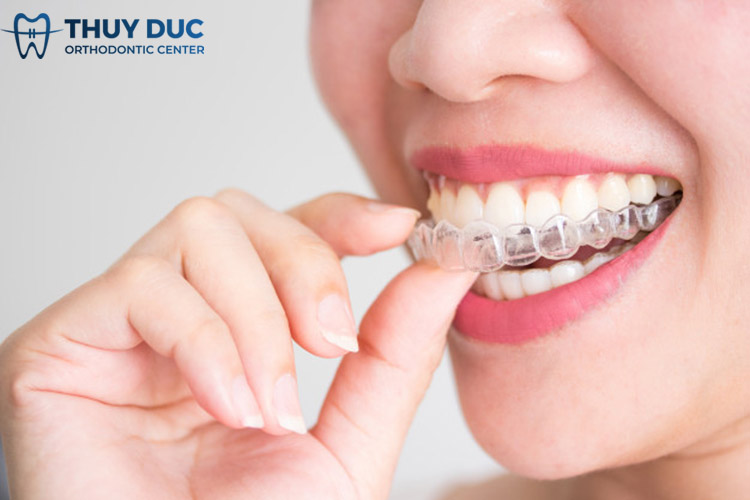 Niềng răng móm với khay niềng trong suốt Invisalign 1 Niềng răng móm với khay niềng trong suốt Invisalign 1