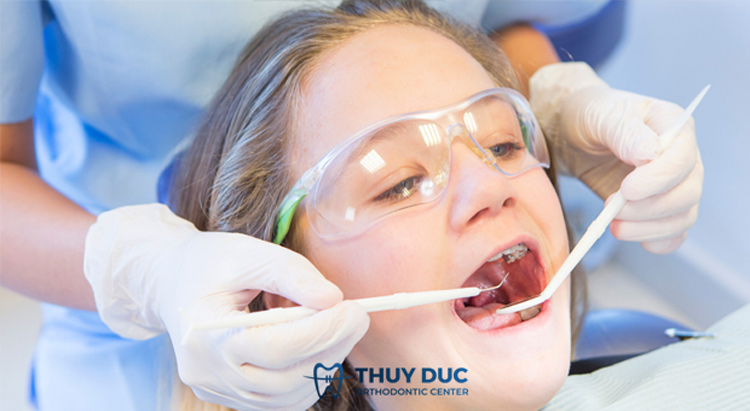 Quy trình niềng răng chung tại các nha khoa 2 Quy trình niềng răng chung tại các nha khoa 2