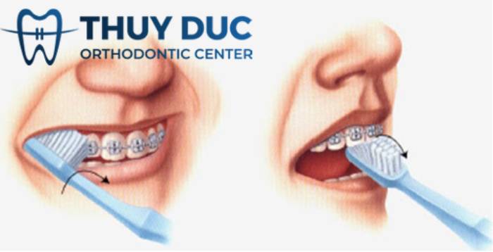 Tạo thói quen chăm sóc răng miệng đúng cách 1 Tạo thói quen chăm sóc răng miệng đúng cách 1