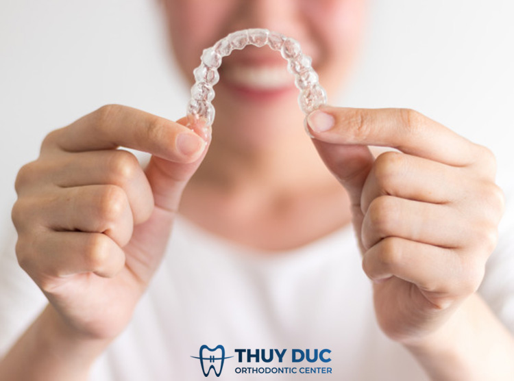 Ưu điểm của niềng răng trong suốt 1