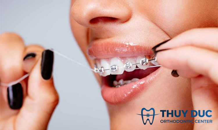 Hướng dẫn cách sử dụng chỉ nha khoa 1 Hướng dẫn cách sử dụng chỉ nha khoa 1