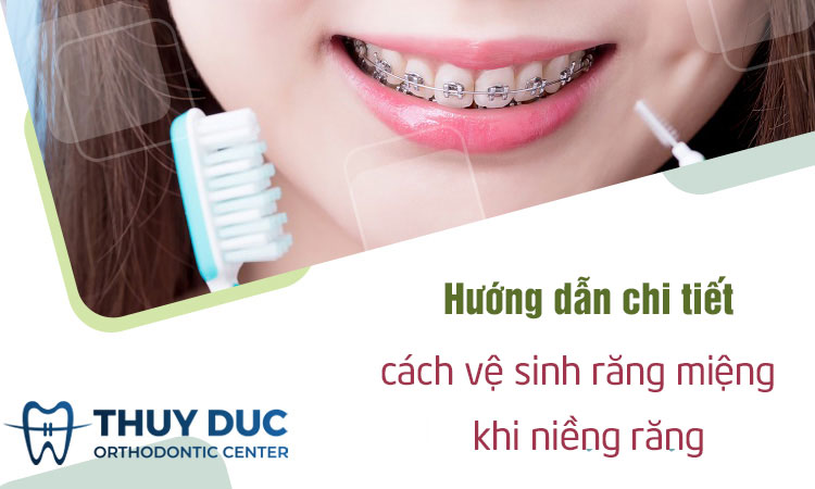 Vệ sinh răng miệng là một yếu tố rất quan trọng khi đeo niềng răng. Tại Nha khoa Lạc Việt Intech, đội ngũ chuyên gia sẽ cung cấp cho bạn một hướng dẫn chi tiết và chăm sóc răng miệng tích cực để giúp niềng răng hiệu quả và an toàn hơn.