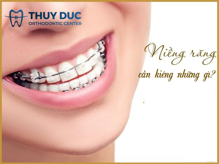 Niềng răng phải kiêng những gì để không ảnh hưởng? 1 Niềng răng phải kiêng những gì để không ảnh hưởng? 1