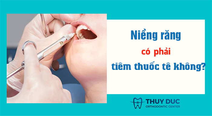 Niềng răng có phải tiêm thuốc tê không? 1 Niềng răng có phải tiêm thuốc tê không? 1