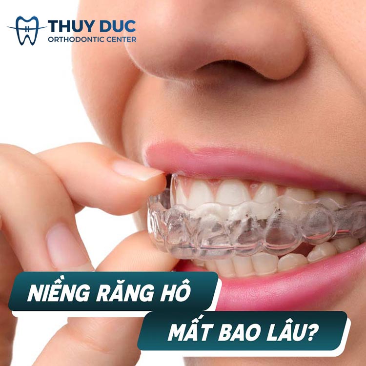 Có thể tăng tốc quá trình niềng răng hô không?
