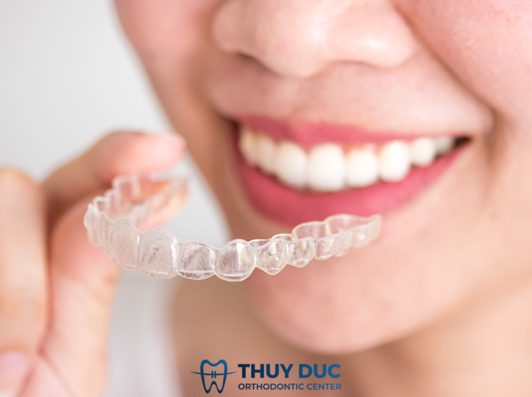 Niềng răng trong suốt Invisalign 1 Niềng răng trong suốt Invisalign 1