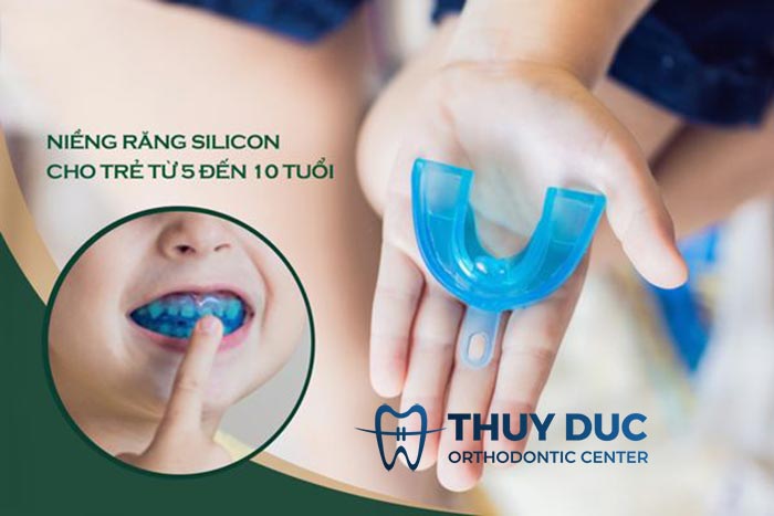 Chi phí niềng răng Silicon 1 Chi phí niềng răng Silicon 1