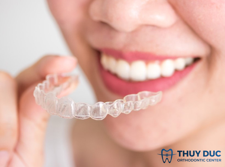 Niềng răng trong suốt Invisalign 1 Niềng răng trong suốt Invisalign 1