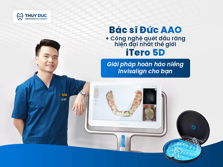 Niềng răng trong suốt Invisalign 1