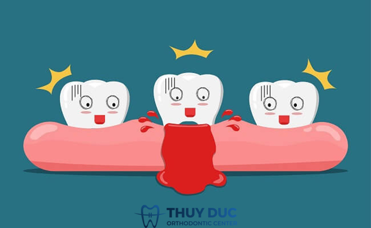 Tình trạng răng miệng 1 Tình trạng răng miệng 1