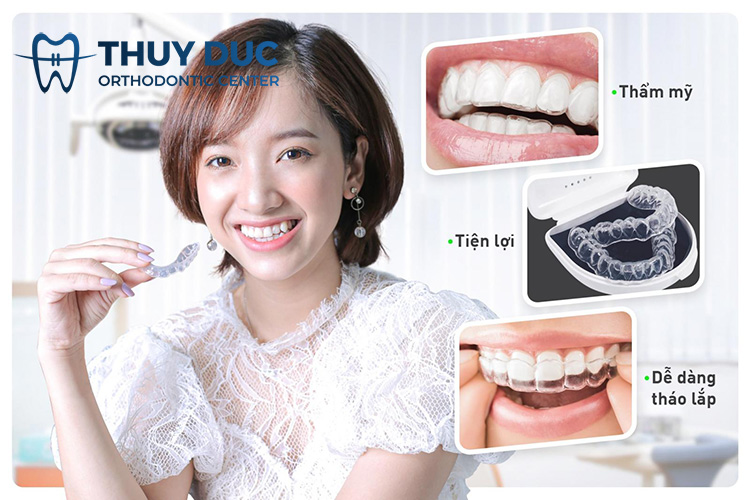 Ưu điểm của niềng răng bằng nhựa 1 Ưu điểm của niềng răng bằng nhựa 1