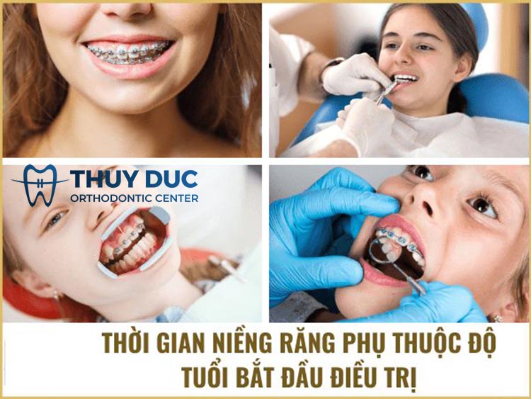 Độ tuổi niềng răng 1 Độ tuổi niềng răng 1
