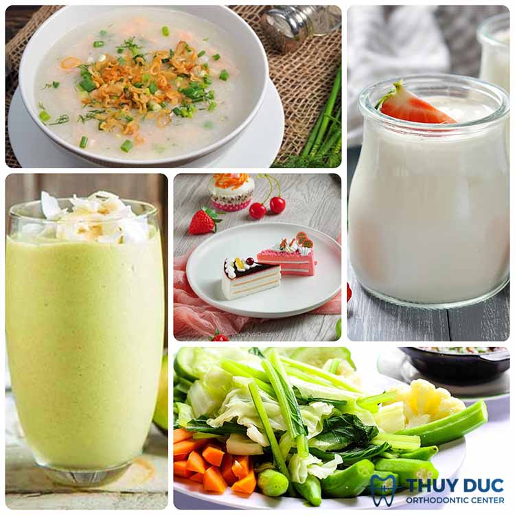 Các thực phẩm nên dùng 1 Các thực phẩm nên dùng 1