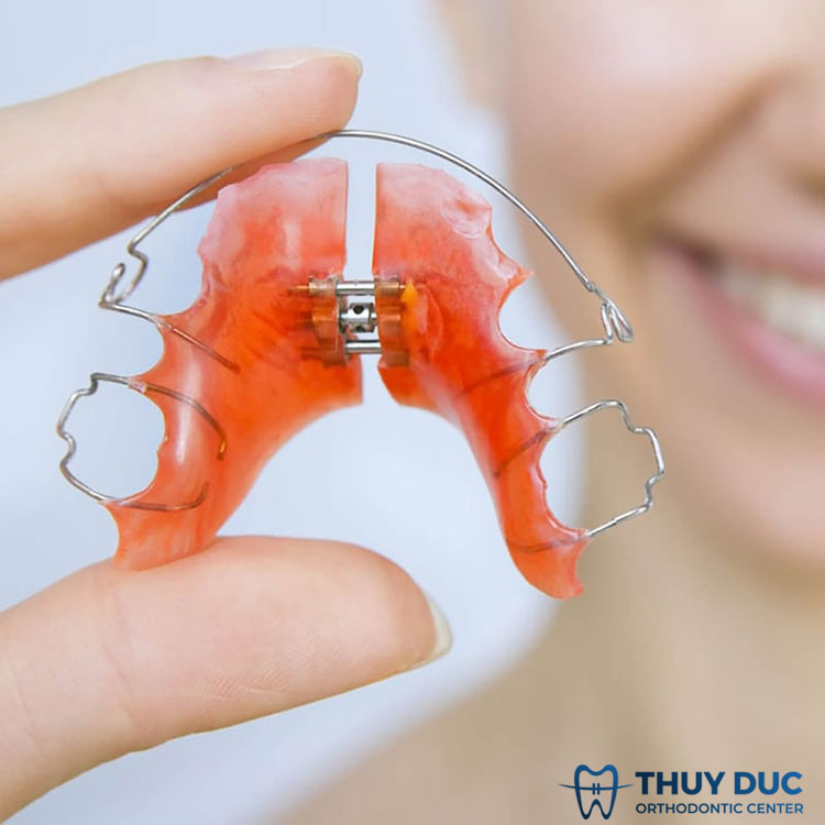 Cách bảo quản hàm duy trì 1 Cách bảo quản hàm duy trì 1