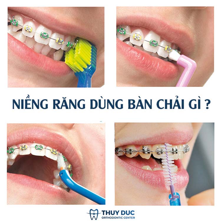 Chọn bàn chải đánh răng thích hợp 1