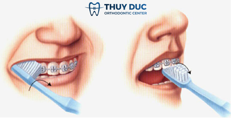 Học cách chải răng chuẩn nhất 1 Học cách chải răng chuẩn nhất 1