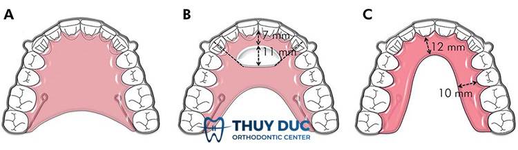 Hướng dẫn cách sử dụng hàm duy trì Hawley chuẩn nhất 1 Hướng dẫn cách sử dụng hàm duy trì Hawley chuẩn nhất 1