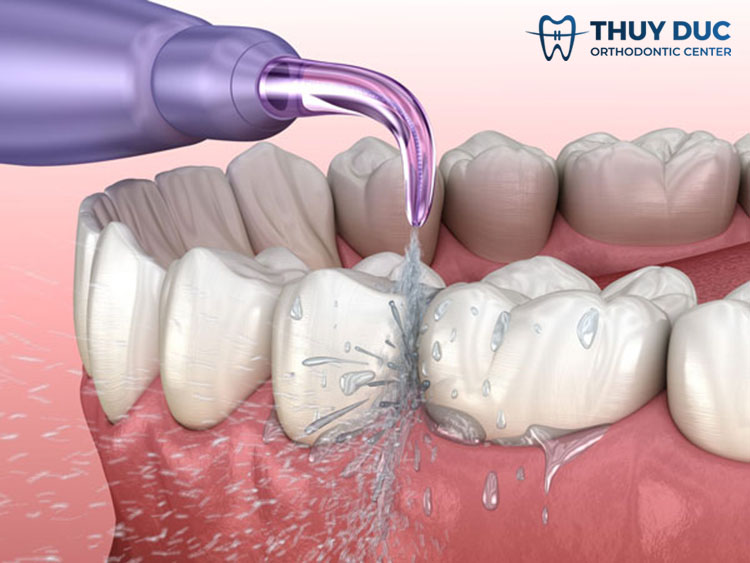 Dùng máy tăm nước 1