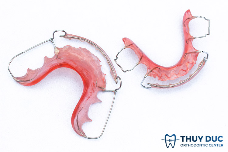 Thời gian đeo hàm duy trì Hawley khoảng bao lâu? 1 Thời gian đeo hàm duy trì Hawley khoảng bao lâu? 1