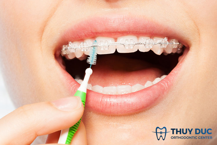 Về cách chăm sóc, vệ sinh răng miệng 1 Về cách chăm sóc, vệ sinh răng miệng 1