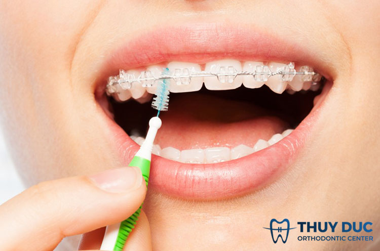 Quá trình chăm sóc dễ dàng 1 Quá trình chăm sóc dễ dàng 1