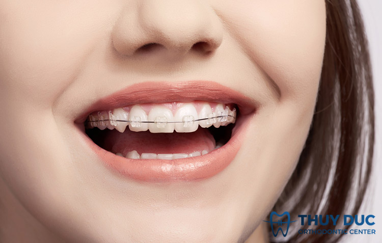 Chi phí hợp lý 1 Chi phí hợp lý 1