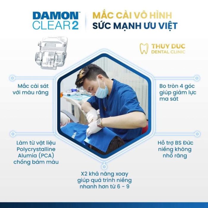 Mắc cài sứ tự động Damon Clear Q2 1 Mắc cài sứ tự động Damon Clear Q2 1