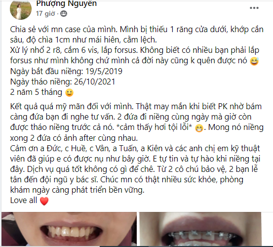 Feedback của khách hàng niềng răng tại Nha khoa Thúy Đức 5