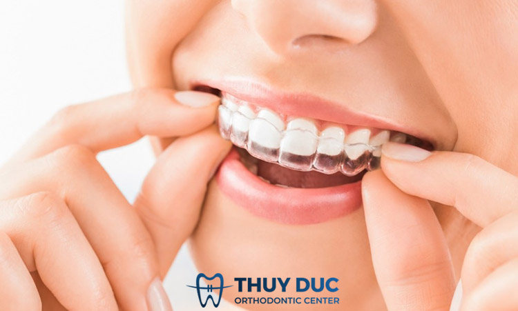 Chỉnh răng móm bằng khay niềng trong suốt có đau không? 1