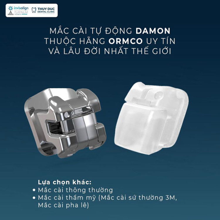 Đa dạng các phương pháp niềng răng 1