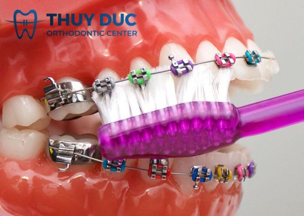 Chải răng đúng cách 1 Chải răng đúng cách 1