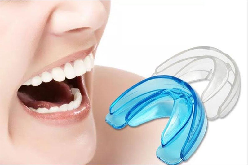 Dụng cụ niềng răng bán trên mạng 1 Dụng cụ niềng răng bán trên mạng 1