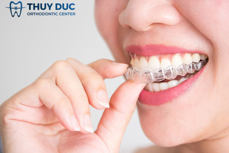 Niềng răng 3 Niềng răng 3