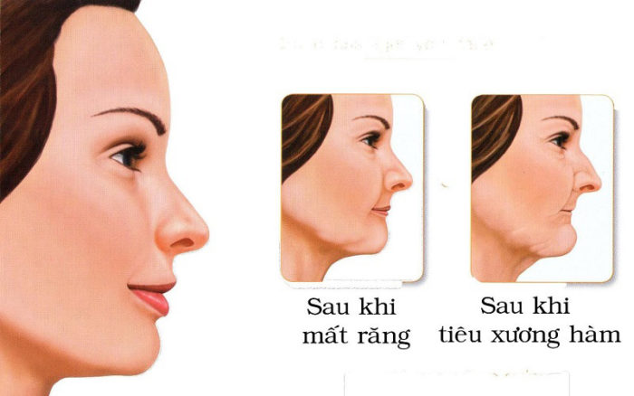 Ảnh hưởng xấu tới thẩm mỹ 1