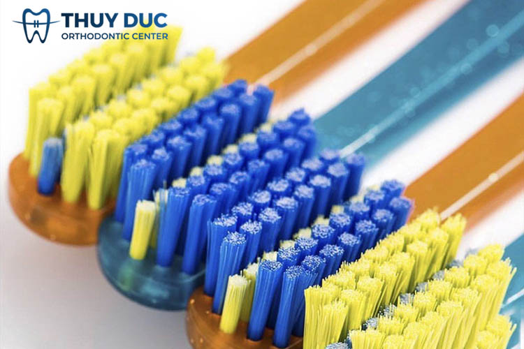 Vì sao người niềng răng cần có bàn chải đánh răng riêng biệt? 1