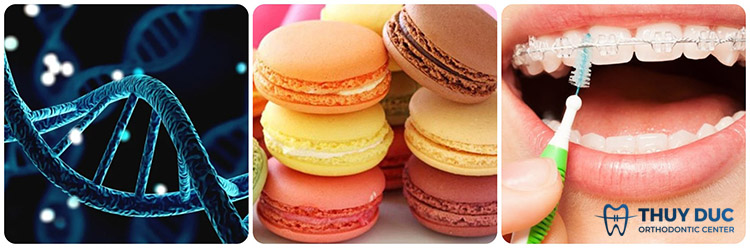 Phân tích nguyên nhân khiến răng bị yếu 1 Phân tích nguyên nhân khiến răng bị yếu 1