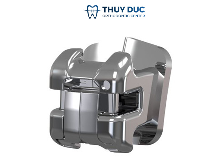 Những thông tin cần biết về mắc cài kim loại Damon Q2 1 Những thông tin cần biết về mắc cài kim loại Damon Q2 1