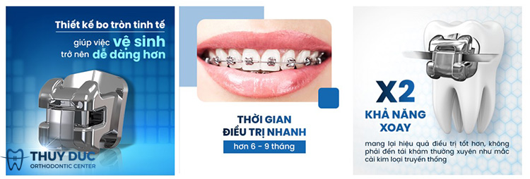 Thiết kế nổi bật của mắc cài kim loại Damon Q2 1 Thiết kế nổi bật của mắc cài kim loại Damon Q2 1