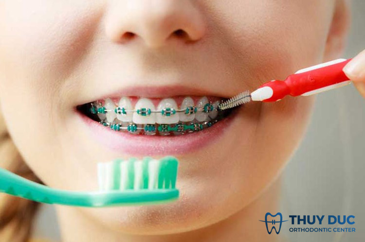 Vệ sinh răng miệng đúng cách 1 Vệ sinh răng miệng đúng cách 1