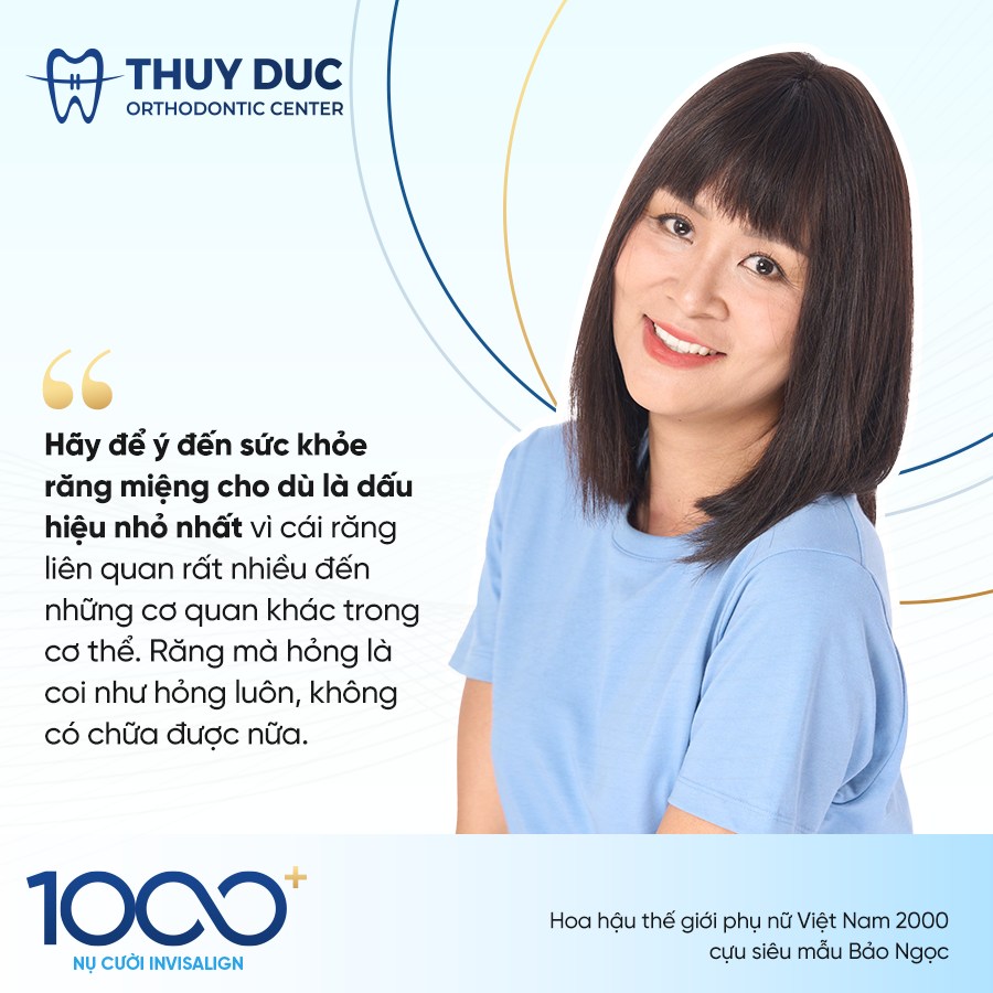 CHUYỆN BÂY GIỜ MỚI KỂ VỀ NỤ CƯỜI INVISALIGN ĐẦU TIÊN 3