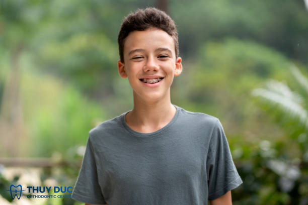 Bị tụt lợi có niềng răng được không? 1
