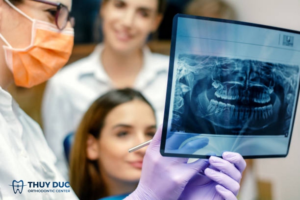 Đối với trường hợp hô hàm 1 Đối với trường hợp hô hàm 1