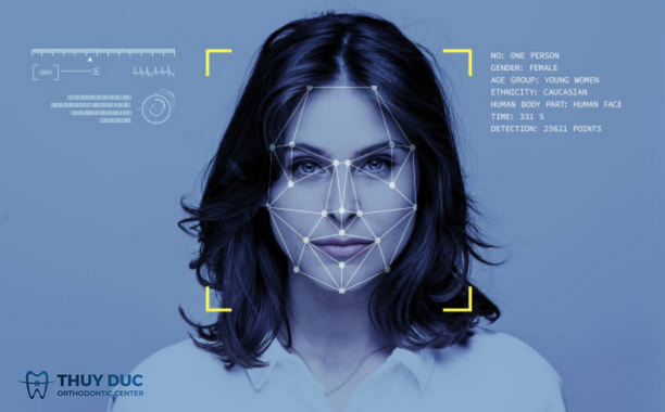 Niềng răng thay đổi khuôn mặt như thế nào? 1